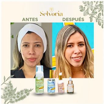 Antes y despues con productos Selvoria