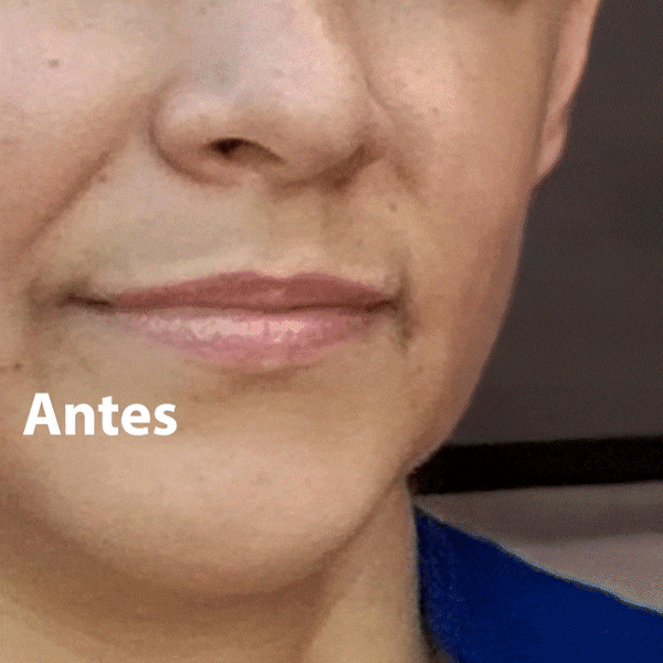 Una piel deshidratada envejece más rápido