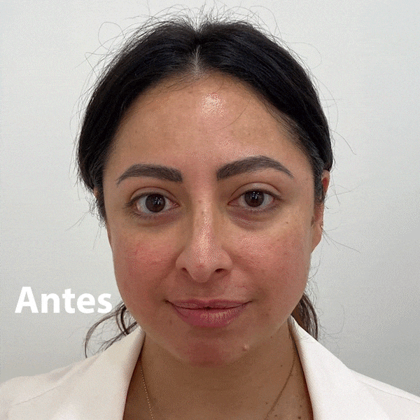 ¡Descubre el poder Anti-edad y Anti-imperfecciones del Bio-Retinol!
